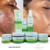 KIT PUISSANT ANTI-ACNÉ  ET TACHES DE BOUTONS AU CHANVRE ET À à L'ARBRE À THÉ, TRÈS EFFICACE 100% BIO