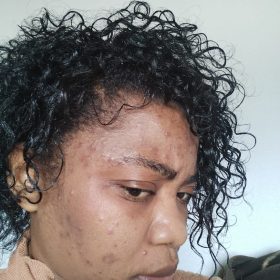 GAMME BLANCHISSANTE TEINT MÉTIS PRO-AVANCÉE À LA PAPAYE ET AUX GLUTATHIONES ZÉRO IMPERFECTIONS photo review