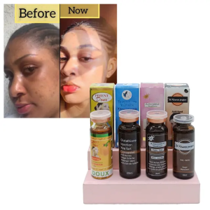 DUO DE 4 GLUTA SÉRUM BLANCHISSANT, CORRECTEUR DE TEINT,POUR LES IMPERFECTIONS
