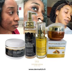 KIT ÉCLAIRCISSANT PUISSANT CORRECTEUR DE TACHES PHALANGES ,MAMIES, TACHES D'ACNÉS, QUINTAUX AU GLUTATHIONE