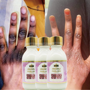 SÉRUM PEELING BLANCHISSANT RAPIDE POUR LES TACHES NOIRES ET ARTICULATIONS FONCÉES