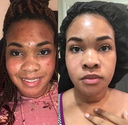GAMME TEINT MÉTIS/HALF CAST 🥕 PUISSANTE BLANCHISSANTE NATURELLE sans effets secondaires au Glutathione ,vitamine C et E et à l’huile de carotte 🥕 photo review