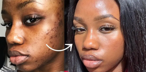 CRÈME GLUTA MIRACLE  ANTI-TACHES 2 EN 1 JOUR & NUIT EXTRA FORTE POUR  LES TACHES DU VISAGES , COU, MAMIES, PIEDS, MAINS photo review
