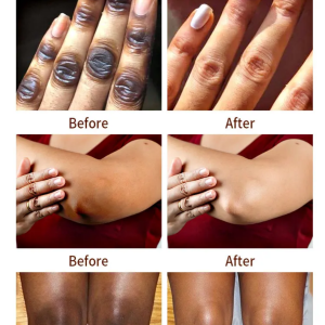 8-PRODUITS POUR TACHES, QUINTAUX, IMPERFECTIONS,MÉLASME..