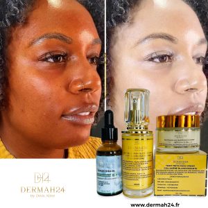 KIT SOIN DE VISAGE: SÉRUM VISAGE 2,5% ACIDE HYALURONIQUE+ SÉRUM EXTRA WHITE ET CRÈME EXTRA BLANCHISSANT