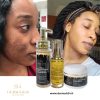 KIT ÉCLAIRCISSANT PUISSANT CORRECTEUR DE TACHES NOIRES, QUINTAUX ,MAMIES, TACHES D'ACNÉS, TACHES BRUNES AU GLUTATHION
