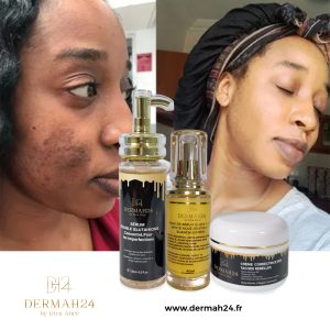 KIT ÉCLAIRCISSANT PUISSANT CORRECTEUR DE TACHES NOIRES, QUINTAUX ,MAMIES, TACHES D'ACNÉS, TACHES BRUNES AU GLUTATHION
