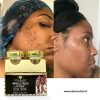 CRÈME GLUTA MIRACLE  ANTI-TACHES 2 EN 1 JOUR & NUIT EXTRA FORTE POUR  LES TACHES DU VISAGES , COU, MAMIES, PIEDS, MAINS
