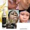 KIT ANTI-TACHES CRÈME VISAGE,SÉRUM GLUTA MIRACLE POUR LES TACHES REBELLES: VISAGES ,MAIN COU,PIEDS AU GLUTATHIONE