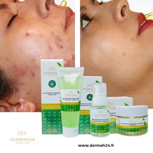 KIT ANTI-ACNÉS : GEL NETTOYANT, SÉRUM, GEL  HYDRATANT À L'ALOÈS VERRA