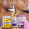 🔥DUO✨ DITES ADIEU À L’ACNÉ & AUX TACHES ✨ AVEC L'HUILE D'ACIDE KOJIQUE, TAMPONS NETTOYANTS À L'ACIDE KOJIQUE ET AU CURCUMA ET SAVON AU GLUTATHION & CURCUMA