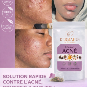 THÉ - INFUSION ACNÉ – SOLUTION NATURELLE CONTRE BOUTONS & IMPERFECTIONS