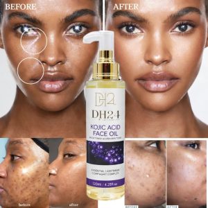 🌟GLOW🌟 L'HUILE DE VISAGE À 'ACIDE KOJIQUE DH24 ÉCLAT INTENSE–TEINT UNIFORME–ANTI-TACHES