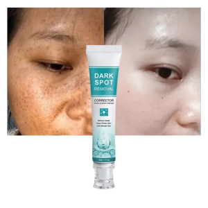 CRÈME CORRECTRICE ANTI-TACHES,Éclaircissante Hydratante Anti-Taches Pigmentaires, Anti-Taches de Rousseur